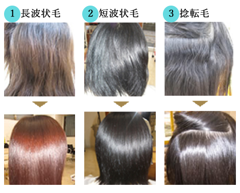 クセレベルスケール