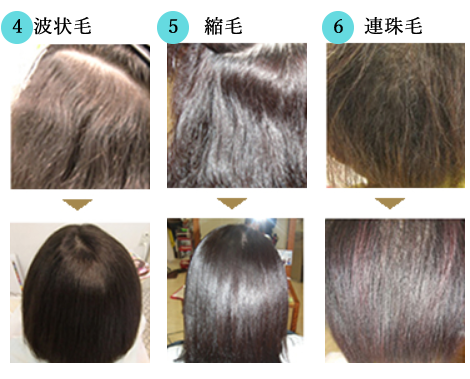 クセレベルスケール